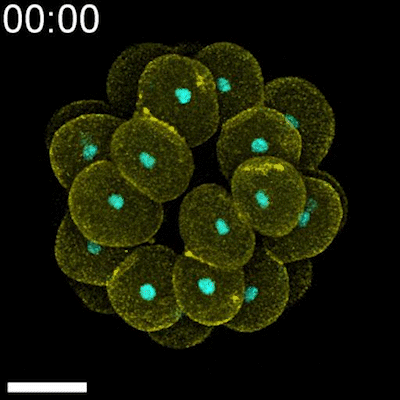 Timelapse of a developing sea star embryo, showing cell membranes in yellow and nuclei in cyan