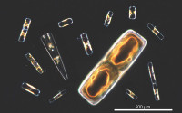 Composite image of diatoms seen through a microscope
