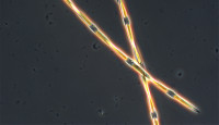 Microscopic view of domoic acid producing Pseudo-nitzschia diatom