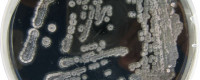 Environmental microorganisms in petri dish. Photo courtesy of Simon Fraser University