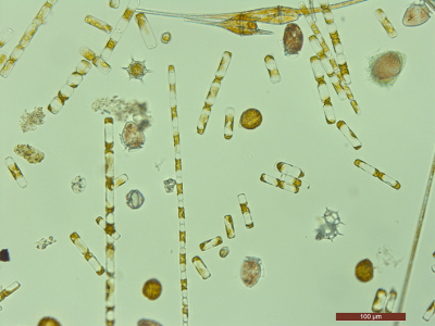 A microscopic image of several different phytoplankton species.