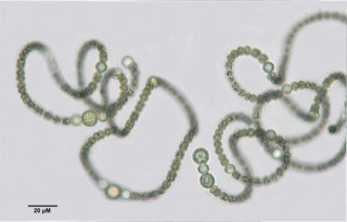 cyanobacteria sample under microscope