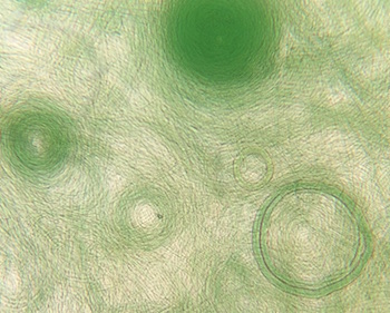Microscopic view of algae