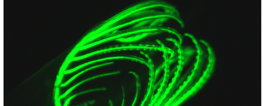 Behind a Marine Creature’s Bright Green Fluorescent Glow | Scripps